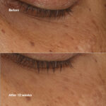 Siero Illuminante Clinique ALL ABOUT EYES 10 ml