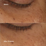 Siero Illuminante Clinique ALL ABOUT EYES 10 ml