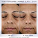 Crema Giorno Lancôme Rénérgie Lift Ultra 50 ml