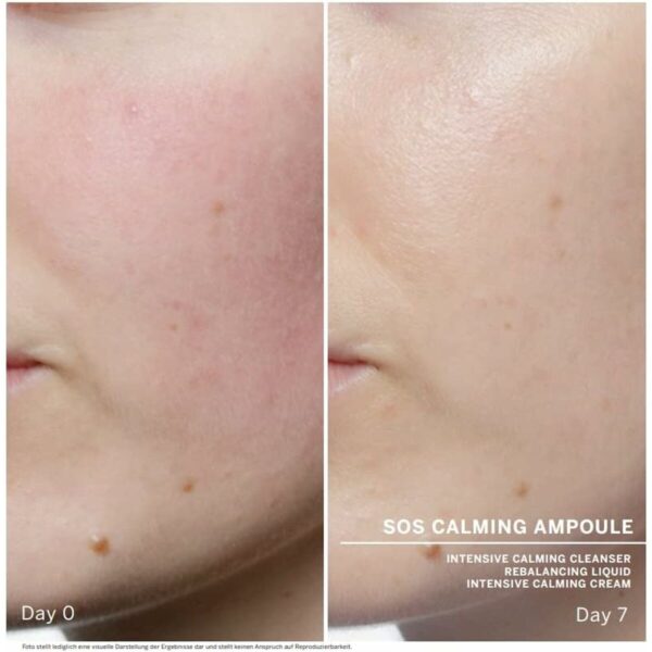 Trattamento Viso Babor Sos Calming