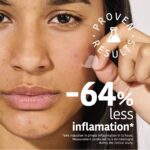 Crema Viso Iroha ACNE PRONE SKIN